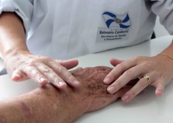 Secretaria de Saúde de BC alerta sobre cuidado com a pele durante o verão