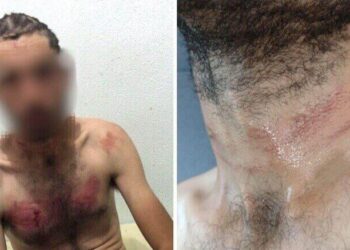 Homem com Deficiência Torturado por Guardas em BC Será Indenizado em R$ 100 Mil