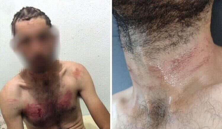 Homem com Deficiência Torturado por Guardas em BC Será Indenizado em R$ 100 Mil