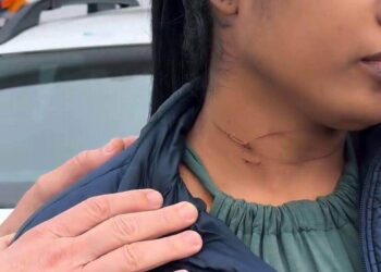 Linha com cerol quase degola moradora em Itajaí