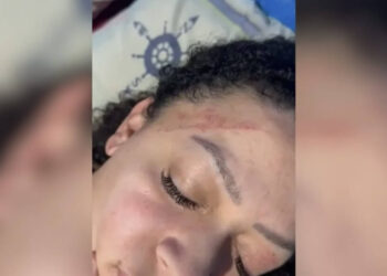 Mulher que levou tapa no rosto durante ação da PM relata brutalidade policial