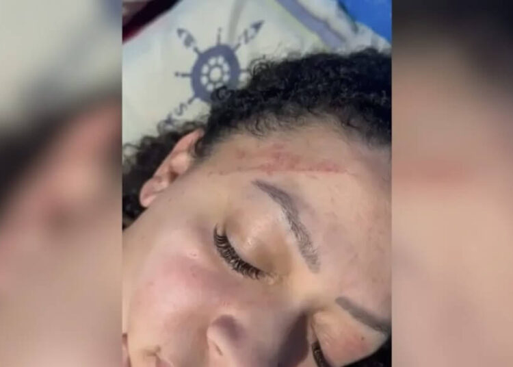 Mulher que levou tapa no rosto durante ação da PM relata brutalidade policial